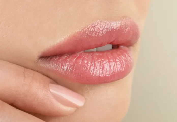 How to Heal Cracked Lip Corners Fast How to Heal Cracked Lip Corners Fast