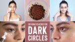 Home Remedies for Dark Circles