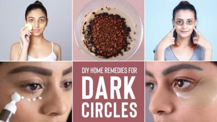Home Remedies for Dark Circles Home Remedies for Dark Circles