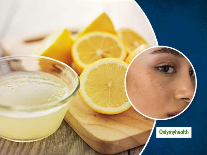 Remove Dark Spots Naturally with Lemon Juice wellhealthorganic.com/easily-remove-dark-spots-lemon-juice